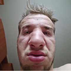 Хулео_Трепацио